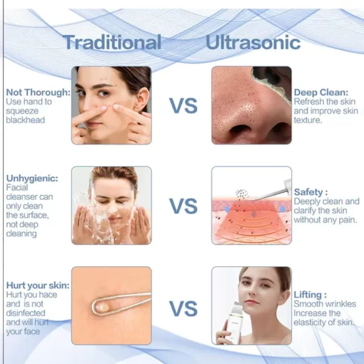 SAUQSTORE® Ultrasonic Facial Skin Scrubber